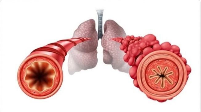 84511-ilustrasi-bronkiolus-struktur-dan-fungsi-bronkiolu-freepik.jpg