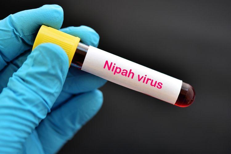 Apakah Virus Nipah Berbahaya?